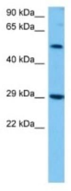 Gasdermin-C Rabbit anti-Mouse, Polyclonal, Novus Biologicals:Antibodies:Primary